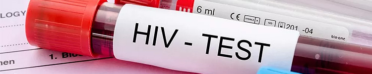 Анализы на ВИЧ
